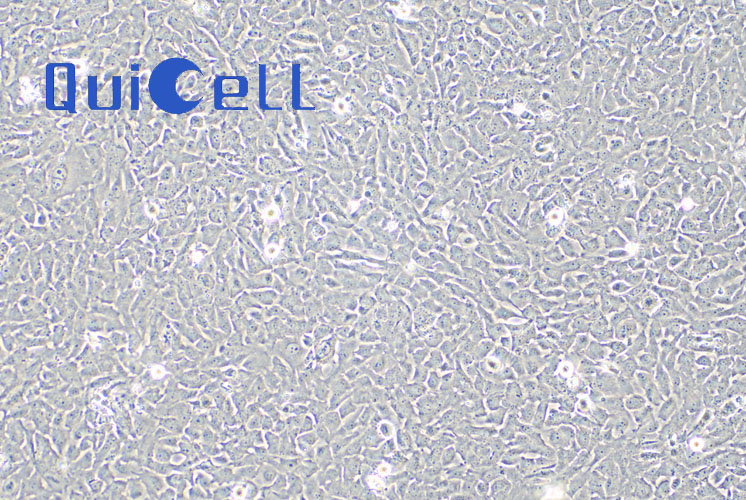 永生化的人Ⅱ型肺泡上皮细胞 Immortalized Human Type II Alveolar Epithelial Cells